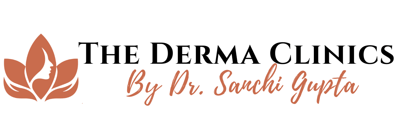Skin Fungal Infection Treatment – Expert Dermatology Care